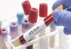 STD Test For Chlamydia and Gonorrhea