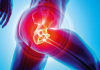 When Do You Need Hip Replacement Surgery and What is It?