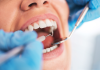 What are Important Reasons to Take Your Dental Health Seriously?